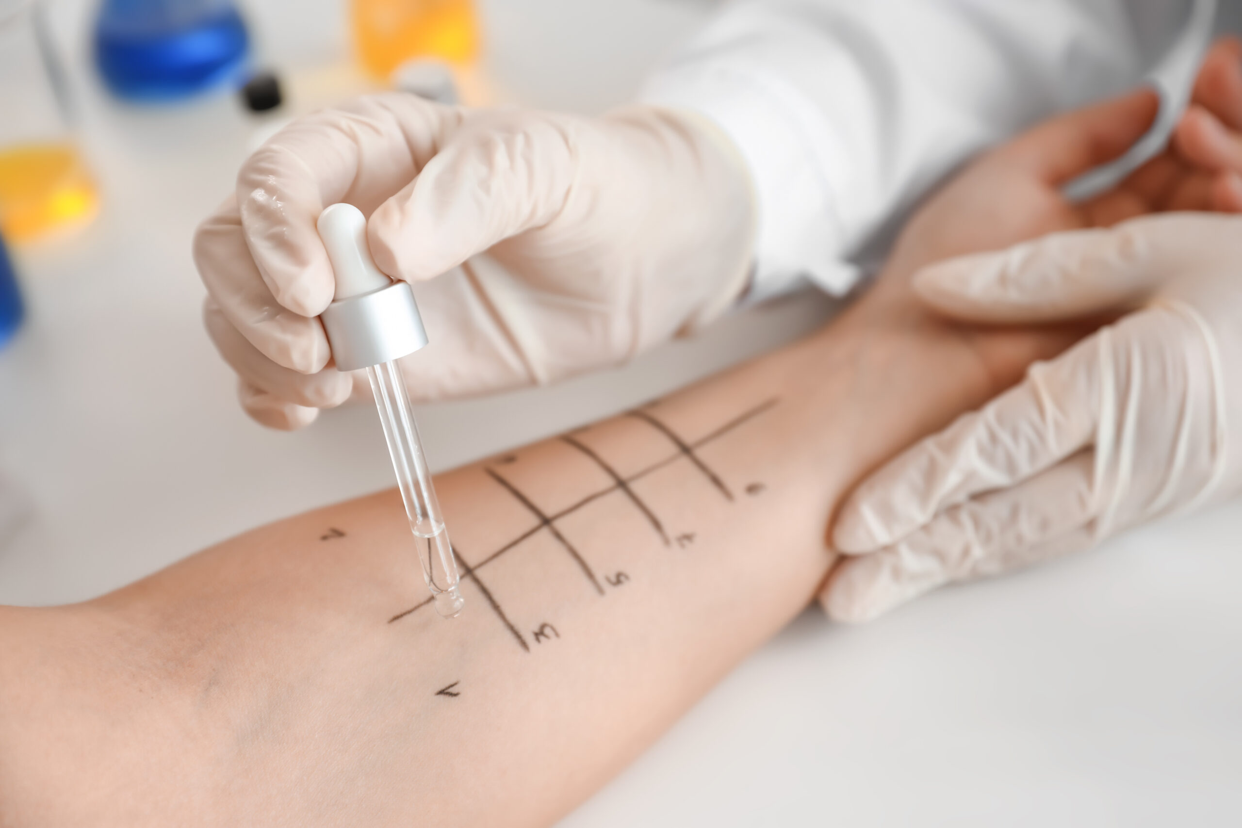Portrait of senior and young woman Young woman undergoing procedure of allergen skin tests in clinic
