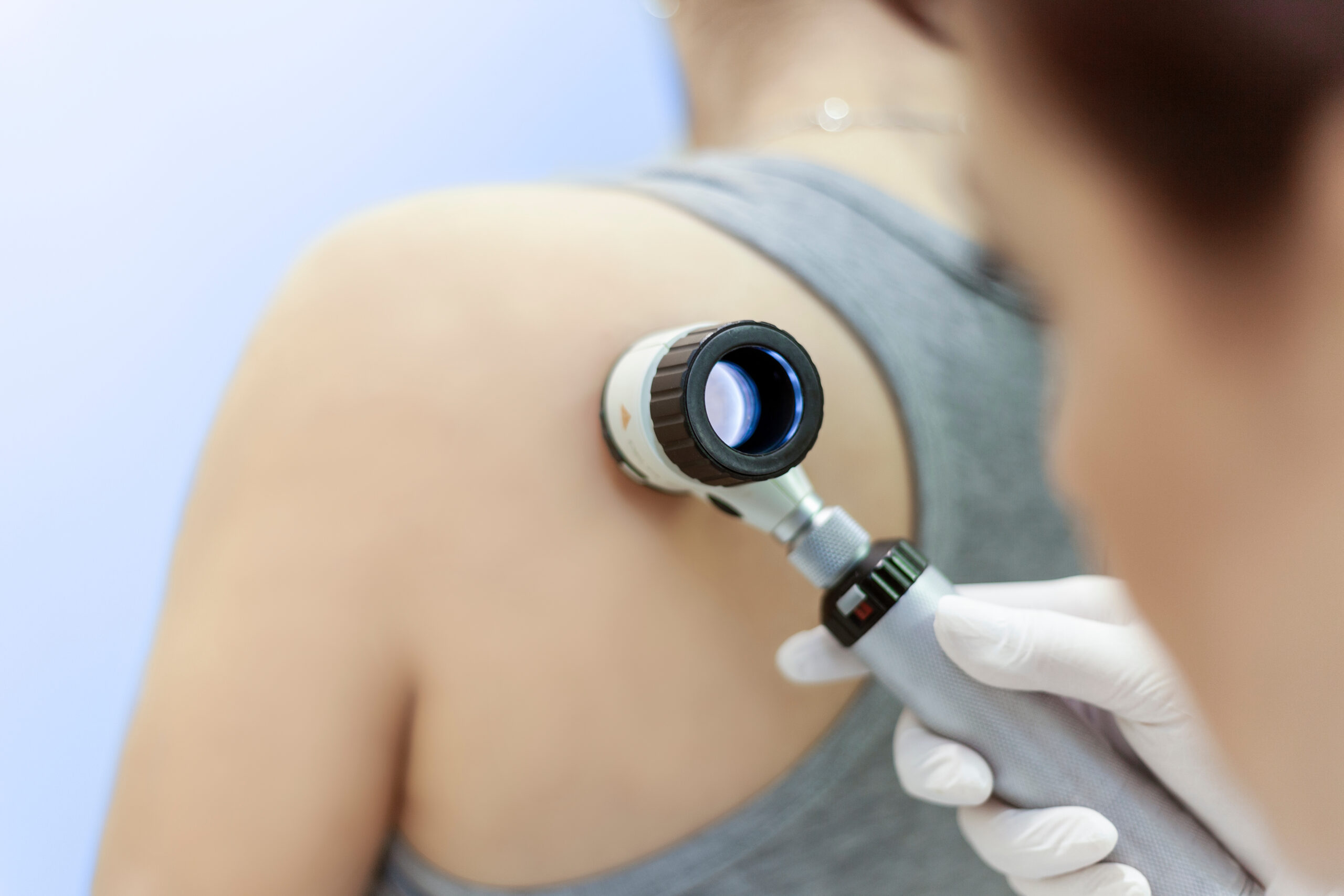 Portrait of senior and young woman dermatologist examines birthmarks on the patient's skin with a dermatoscope. Dermatology, skin mole examining. looking for signs of melonoma or skin cancer.